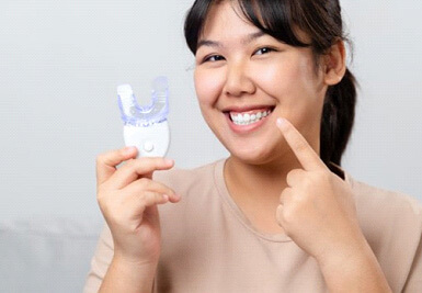 a woman undergoing take-home teeth whitening treatment