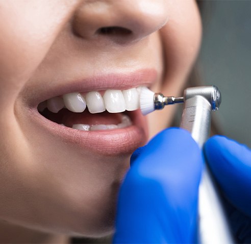 Someone's teeth being polished